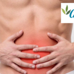 Colon irritable y Colitis ulcerosa: Cómo alimentarse